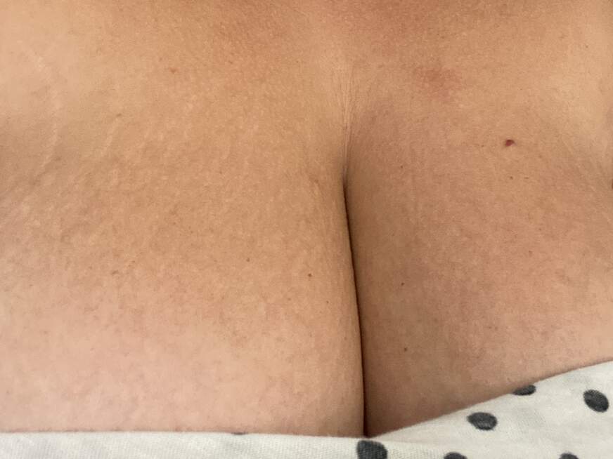 S*******r-Lisa - Bolg