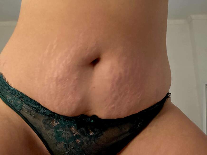 Sternenm******n - Bolg