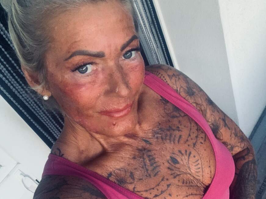 Lutsch-Lieschen - Bolg