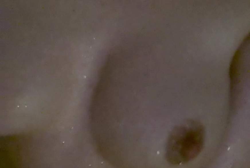 Zuzanny: Beim Ölbad musste das Thermometer dran glauben