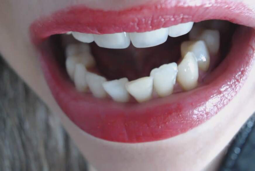 close-up of mouth and teeth von FetishGoddess pic2