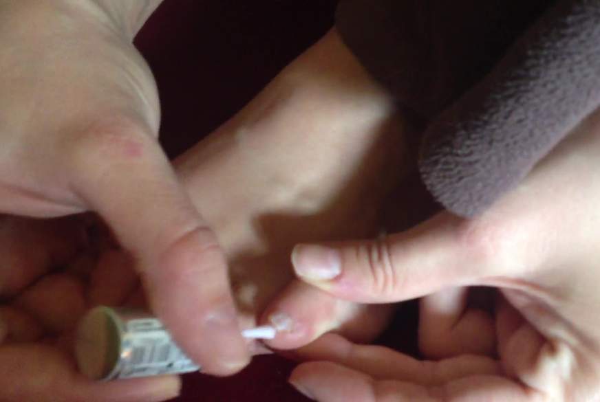 hairykittyx: Fußnägel lackert